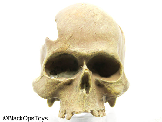 Cracked Human Skull