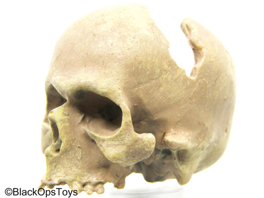 Cracked Human Skull