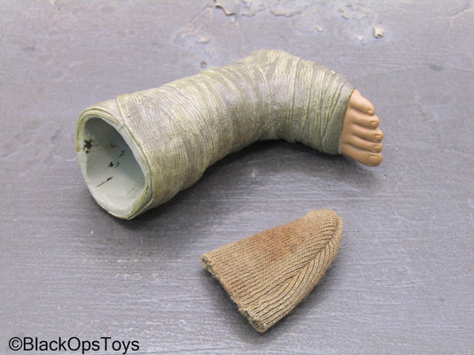 Foot In Cast